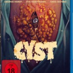 X800囊肿 CYST (2020)